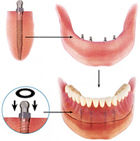 Curare i denti in Moldavia Logo